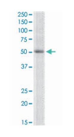 TRIP6, Goat, Polyclonal Antibody, Abnova 100&mu;g; Unlabeled:Antibodies,
