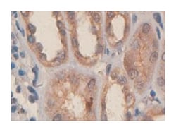 PDGFC, Rabbit, Polyclonal Antibody, Abnova 100&mu;g; Unlabeled:Antibodies,