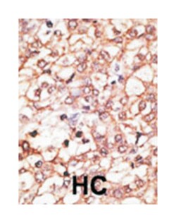 KREMEN1 Rabbit anti-Human, Polyclonal Antibody, Abnova 400 &mu;L | Buy Online | Abnova Corporation | Fisher Scientific