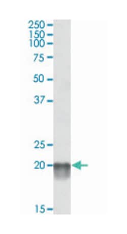 NDUFS7, Goat, Polyclonal Antibody, Abnova 100 &mu;g | Buy Online | Abnova Corporation | Fisher Scientific