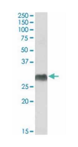 HLA-DQA2, Goat, Polyclonal Antibody, Abnova 100&mu;g; Unlabeled:Antibodies,