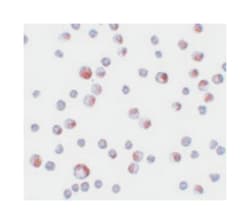 TCTN3, Rabbit, Polyclonal Antibody, Abnova 100&mu;g; Unlabeled:Antibodies,