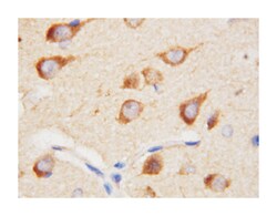 PPID, Rabbit, Polyclonal Antibody, Abnova 100&mu;g; Unlabeled:Antibodies,