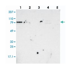 ANGEL1, Rabbit, Polyclonal Antibody, Abnova 100&mu;L; Unlabeled:Antibodies,