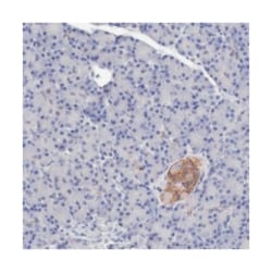 KCND1, Rabbit, Polyclonal Antibody, Abnova 100&mu;L; Unlabeled:Antibodies,