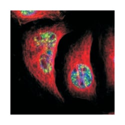 RBM25, Rabbit, Polyclonal Antibody, Abnova 100&mu;L; Unlabeled:Antibodies,