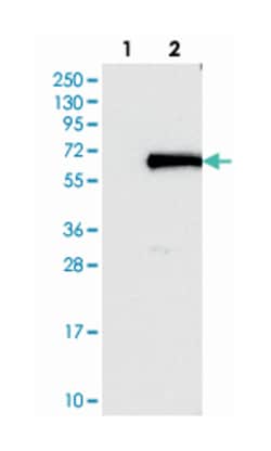 FOXN2, Rabbit, Polyclonal Antibody, Abnova 100&mu;L; Unlabeled:Antibodies,