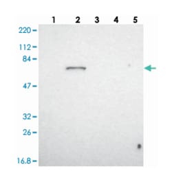 SH2B3, Rabbit, Polyclonal Antibody, Abnova 100 &mu;L | Buy Online | Abnova Corporation | Fisher Scientific