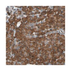 CLCC1 Rabbit anti-Human, Polyclonal Antibody, Abnova 100 &mu;L | Buy Online | Abnova Corporation | Fisher Scientific