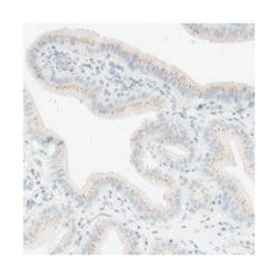 MANEA Rabbit anti-Human, Polyclonal Antibody, Abnova 100&mu;L; Unlabeled:Antibodies,