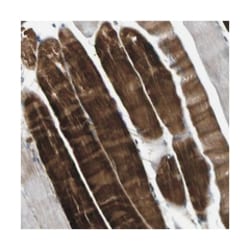 LRRN1, Rabbit, Polyclonal Antibody, Abnova 100&mu;L; Unlabeled:Antibodies,