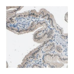 GPR158, Rabbit, Polyclonal Antibody, Abnova 100 &mu;L | Buy Online | Abnova Corporation | Fisher Scientific