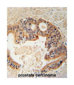 DYRK1A Rabbit anti-Human, Polyclonal Antibody, Abnova 400 &mu;L | Buy Online | Abnova Corporation | Fisher Scientific