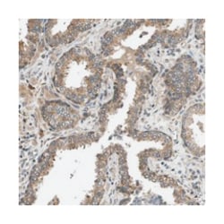 SEC62 Rabbit anti-Human, Polyclonal Antibody, Abnova 100&mu;L; Unlabeled:Antibodies,