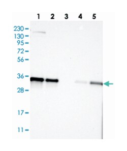 KCTD10, Rabbit, Polyclonal Antibody, Abnova 100&mu;L; Unlabeled:Antibodies,