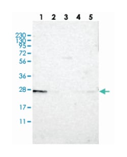 TMED9, Rabbit, Polyclonal Antibody, Abnova 100 &mu;L | Buy Online | Abnova Corporation | Fisher Scientific