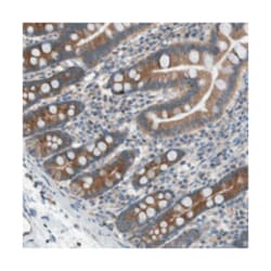 ZDHHC20 Rabbit anti-Human, Polyclonal Antibody, Abnova 100 &mu;L | Buy Online | Abnova Corporation | Fisher Scientific