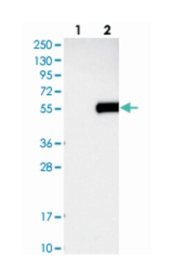 TIMD4 Rabbit anti-Human, Polyclonal Antibody, Abnova 100 &mu;L | Buy Online | Abnova Corporation | Fisher Scientific