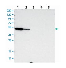 FAR1, Rabbit, Polyclonal Antibody, Abnova 100&mu;L; Unlabeled:Antibodies,