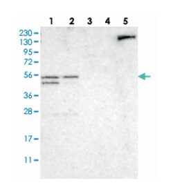 NDRG3 Rabbit anti-Human, Mouse, Rat, Polyclonal Antibody, Abnova 100&mu;L;