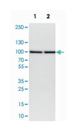 NUP93, Rabbit, Polyclonal Antibody, Abnova 100 &mu;L | Buy Online | Abnova Corporation | Fisher Scientific