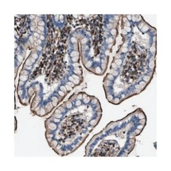 ITPRIPL1, Rabbit, Polyclonal Antibody, Abnova 100 &mu;L | Buy Online | Abnova Corporation | Fisher Scientific