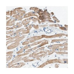HHATL Rabbit anti-Human, Polyclonal Antibody, Abnova 100&mu;L; Unlabeled:Antibodies,