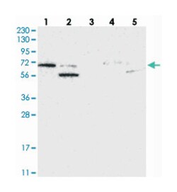 PPM2C Rabbit anti-Human, Polyclonal Antibody, Abnova 100&mu;L; Unlabeled:Antibodies,