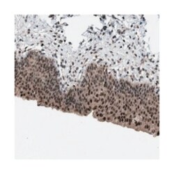 C9orf78 Rabbit anti-Human, Polyclonal Antibody, Abnova 100&mu;L; Unlabeled:Antibodies,