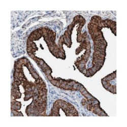 C17orf74, Rabbit, Polyclonal Antibody, Abnova 100 &mu;L | Buy Online | Abnova Corporation | Fisher Scientific