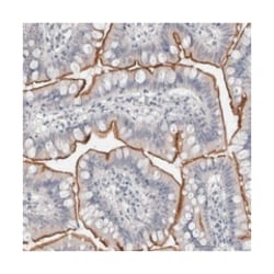 FAM75E1, Rabbit, Polyclonal Antibody, Abnova 100 &mu;L | Buy Online | Abnova Corporation | Fisher Scientific