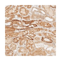 KLF17, Rabbit, Polyclonal Antibody, Abnova 100 &mu;L | Buy Online | Abnova Corporation | Fisher Scientific