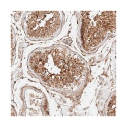 LOC388333, Rabbit, Polyclonal Antibody, Abnova 100 &mu;L | Buy Online | Abnova Corporation | Fisher Scientific