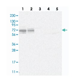 FLJ35848 Rabbit anti-Human, Polyclonal Antibody, Abnova 100 &mu;L | Buy Online | Abnova Corporation | Fisher Scientific