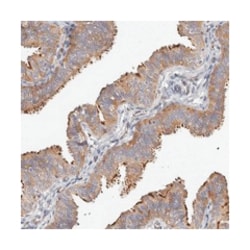 SPAG17 Rabbit anti-Human, Polyclonal Antibody, Abnova 100 &mu;L | Buy Online | Abnova Corporation | Fisher Scientific