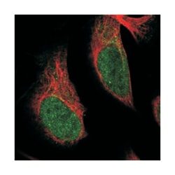 SRCAP, Rabbit, Polyclonal Antibody, Abnova 100 &mu;L | Buy Online | Abnova Corporation | Fisher Scientific