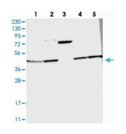 ANKRD34A Rabbit anti-Human, Mouse, Rat, Polyclonal Antibody, Abnova 100 &mu;L | Buy Online | Abnova Corporation | Fisher Scientific