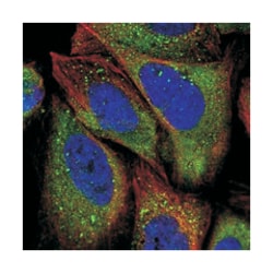 APEH Rabbit anti-Human, Rat, Polyclonal Antibody, Abnova 100 &mu;L | Buy Online | Abnova Corporation | Fisher Scientific