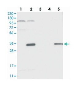 C14orf94, Rabbit, Polyclonal Antibody, Abnova 100 &mu;L | Buy Online | Abnova Corporation | Fisher Scientific