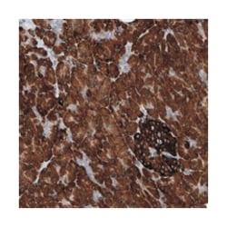 YRDC, Rabbit, Polyclonal Antibody, Abnova 100 &mu;L | Buy Online | Abnova Corporation | Fisher Scientific