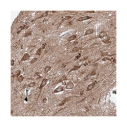 FOXRED2 Rabbit anti-Human, Polyclonal Antibody, Abnova 100 &mu;L | Buy Online | Abnova Corporation | Fisher Scientific
