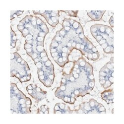 MUC17, Rabbit, Polyclonal Antibody, Abnova 100 &mu;L | Buy Online | Abnova Corporation | Fisher Scientific