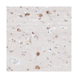 GABRG1 Rabbit anti-Human, Polyclonal Antibody, Abnova 100 &mu;L | Buy Online | Abnova Corporation | Fisher Scientific