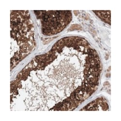 EHBP1 Rabbit anti-Human, Polyclonal Antibody, Abnova 100&mu;L; Unlabeled:Antibodies,