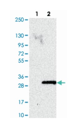 C11orf51, Rabbit, Polyclonal Antibody, Abnova 100&mu;L; Unlabeled:Antibodies,
