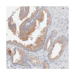 GRINA Rabbit anti-Human, Polyclonal Antibody, Abnova 100&mu;L; Unlabeled:Antibodies,