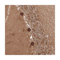 C10orf113, Rabbit, Polyclonal Antibody, Abnova 100 &mu;L | Buy Online | Abnova Corporation | Fisher Scientific