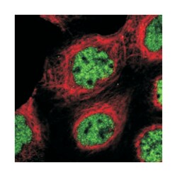 SR140, Rabbit, Polyclonal Antibody, Abnova 100 &mu;L | Buy Online | Abnova Corporation | Fisher Scientific