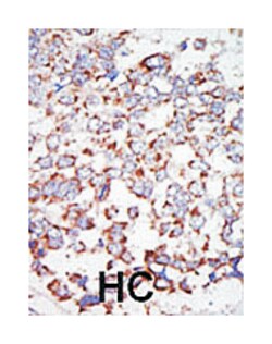 MAP3K7 Rabbit anti-Human, Polyclonal Antibody, Abnova 400 &mu;L | Buy Online | Abnova Corporation | Fisher Scientific