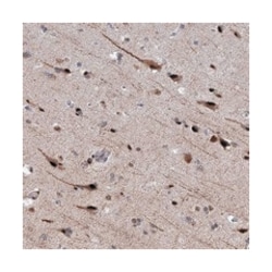PHF8 Rabbit anti-Human, Polyclonal Antibody, Abnova 100 &mu;L | Buy Online | Abnova Corporation | Fisher Scientific